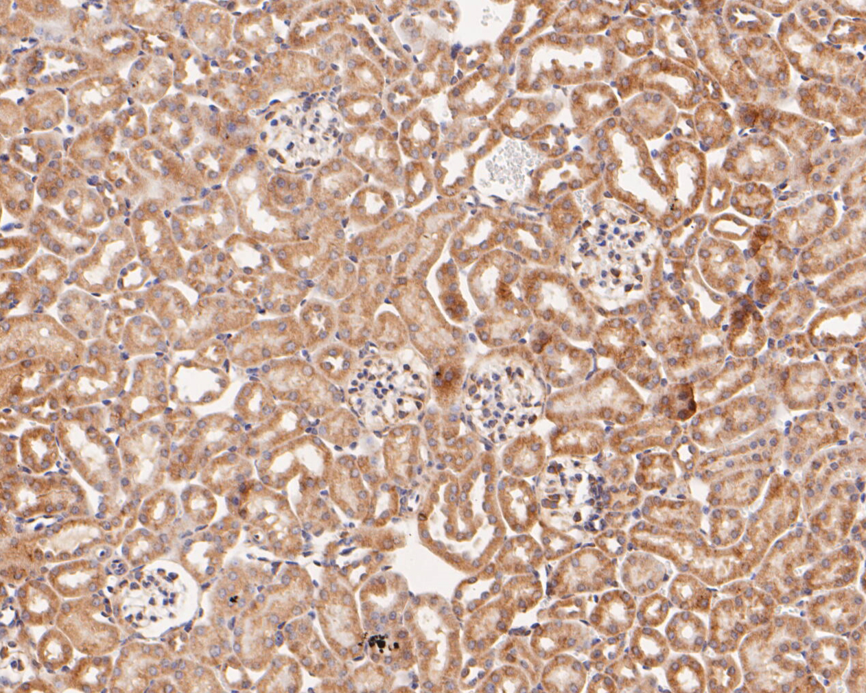 Immunohistochemical analysis of paraffin-embedded mouse kidney tissue using anti-EMC10 antibody. The section was pre-treated using heat mediated antigen retrieval with Tris-EDTA buffer (pH 8.0-8.4) for 20 minutes.The tissues were blocked in 5% BSA for 30 minutes at room temperature, washed with ddH2O and PBS, and then probed with the primary antibody (ER1902-08, 1/200) for 30 minutes at room temperature. The detection was performed using an HRP conjugated compact polymer system. DAB was used as the chromogen. Tissues were counterstained with hematoxylin and mounted with DPX.