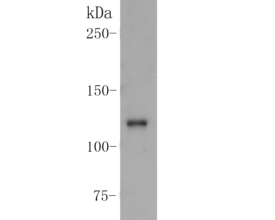 Western blot analysis of CD163 on SHSY5Y cell lysate. Proteins were transferred to a PVDF membrane and blocked with 5% BSA in PBS for 1 hour at room temperature. The primary antibody (ER1902-09, 1/500) was used in 5% BSA at room temperature for 2 hours. Goat Anti-Rabbit IgG - HRP Secondary Antibody (HA1001) at 1:5,000 dilution was used for 1 hour at room temperature.