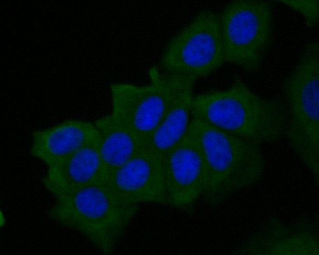 ICC staining of Muc1 in MCF-7 cells (green). Formalin fixed cells were permeabilized with 0.1% Triton X-100 in TBS for 10 minutes at room temperature and blocked with 1% Blocker BSA for 15 minutes at room temperature. Cells were probed with the primary antibody (ER1902-10, 1/200) for 1 hour at room temperature, washed with PBS. Alexa Fluor®488 Goat anti-Rabbit IgG was used as the secondary antibody at 1/1,000 dilution. The nuclear counter stain is DAPI (blue).