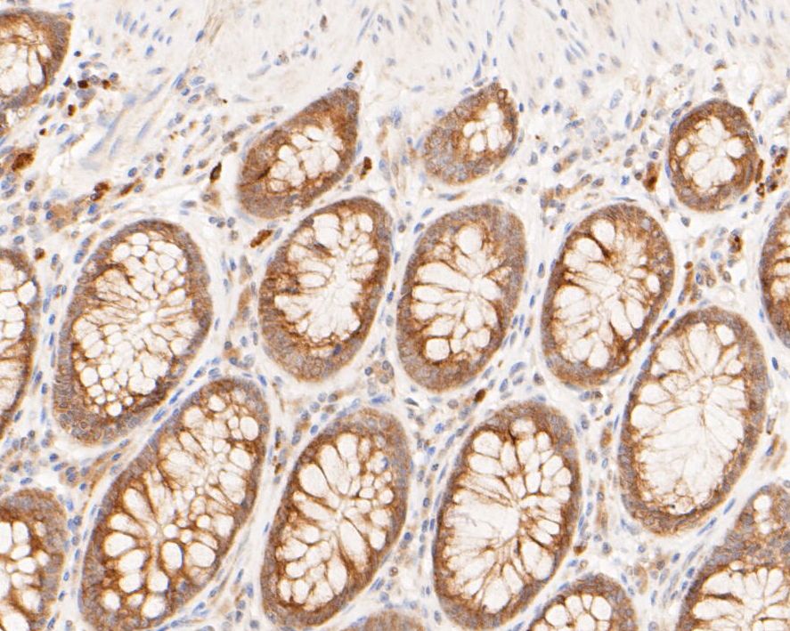 Immunohistochemical analysis of paraffin-embedded human colon tissue using anti-Muc1 antibody. The section was pre-treated using heat mediated antigen retrieval with sodium citrate buffer (pH 6.0) for 20 minutes. The tissues were blocked in 5% BSA for 30 minutes at room temperature, washed with ddH2O and PBS, and then probed with the primary antibody (ER1902-10, 1/200)  for 30 minutes at room temperature. The detection was performed using an HRP conjugated compact polymer system. DAB was used as the chromogen. Tissues were counterstained with hematoxylin and mounted with DPX.