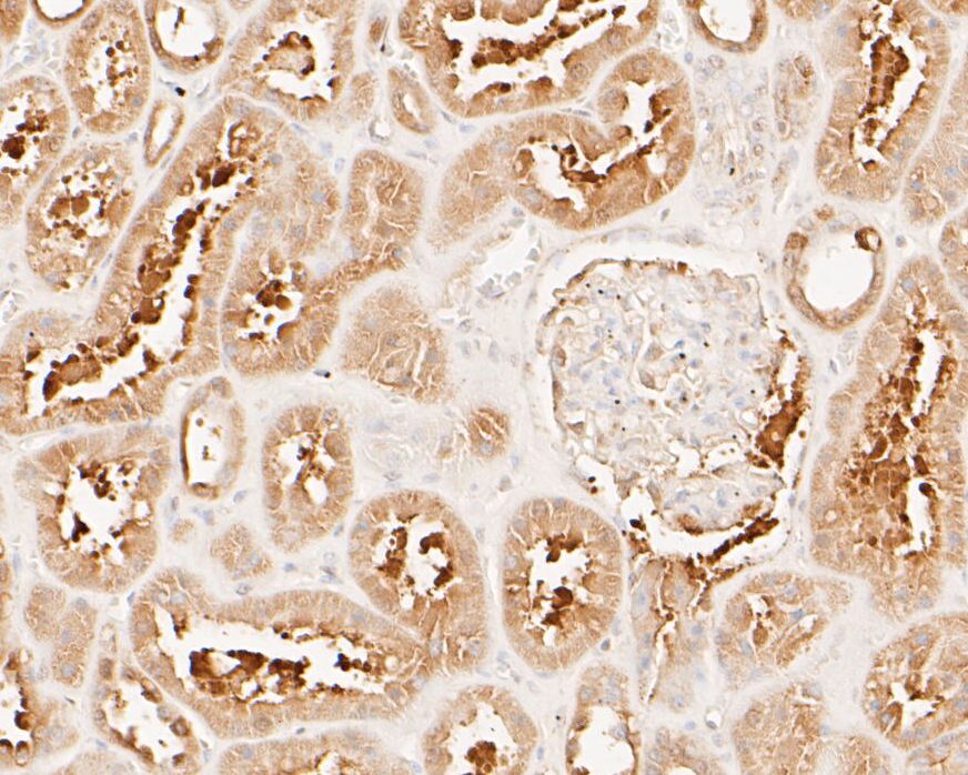 Immunohistochemical analysis of paraffin-embedded human kidney tissue using anti-Muc1 antibody. The section was pre-treated using heat mediated antigen retrieval with sodium citrate buffer (pH 6.0) for 20 minutes. The tissues were blocked in 5% BSA for 30 minutes at room temperature, washed with ddH2O and PBS, and then probed with the primary antibody (ER1902-10, 1/200)  for 30 minutes at room temperature. The detection was performed using an HRP conjugated compact polymer system. DAB was used as the chromogen. Tissues were counterstained with hematoxylin and mounted with DPX.