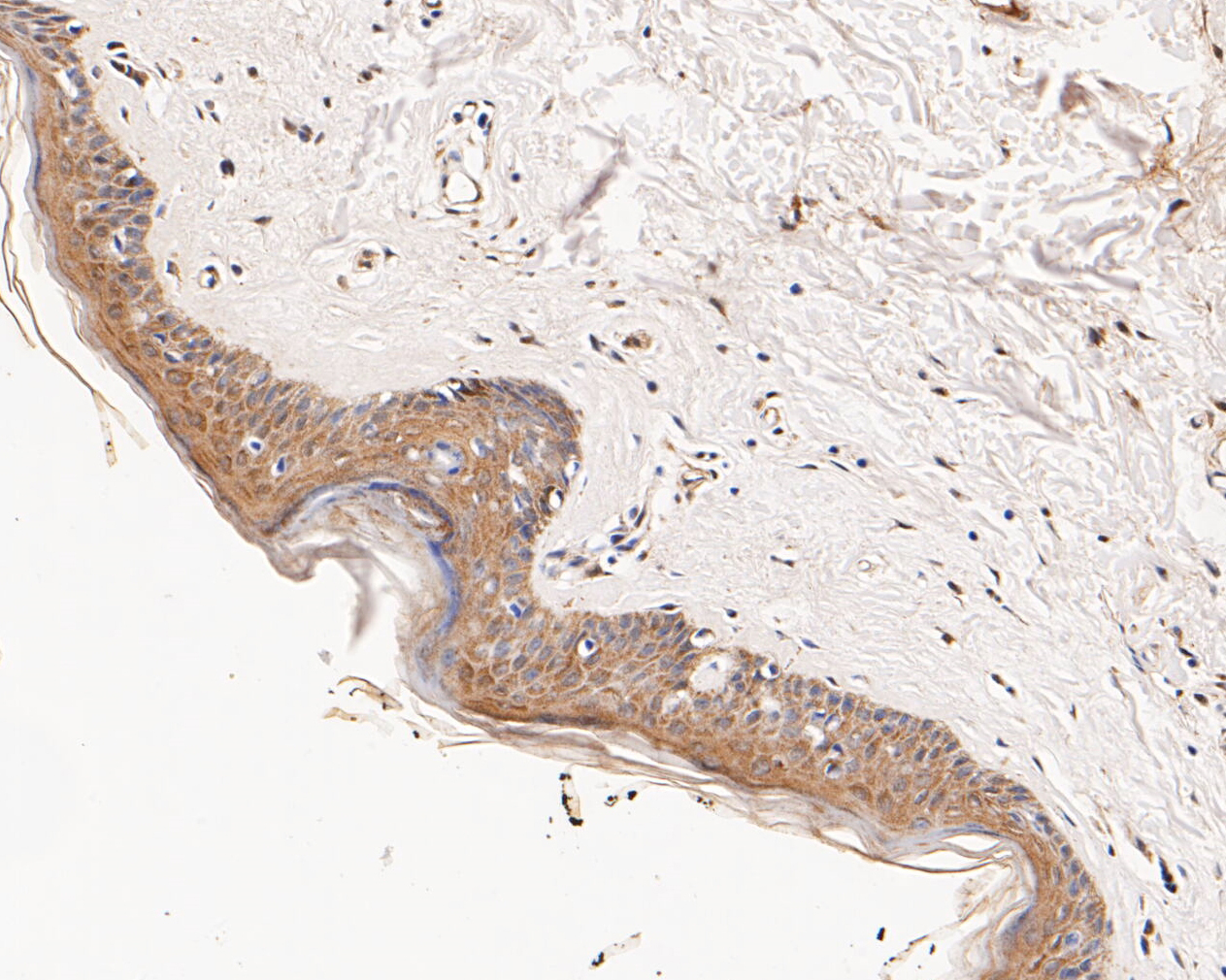 Immunohistochemical analysis of paraffin-embedded human skin tissue using anti-CHRNA3 antibody. The section was pre-treated using heat mediated antigen retrieval with Tris-EDTA buffer (pH 8.0-8.4) for 20 minutes.The tissues were blocked in 5% BSA for 30 minutes at room temperature, washed with ddH2O and PBS, and then probed with the primary antibody (ER1902-13, 1/50) for 30 minutes at room temperature. The detection was performed using an HRP conjugated compact polymer system. DAB was used as the chromogen. Tissues were counterstained with hematoxylin and mounted with DPX.