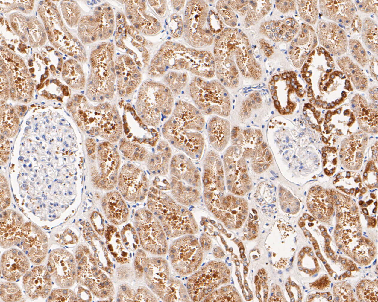 Immunohistochemical analysis of paraffin-embedded human kidney tissue using anti-CHRNA3 antibody. The section was pre-treated using heat mediated antigen retrieval with Tris-EDTA buffer (pH 8.0-8.4) for 20 minutes.The tissues were blocked in 5% BSA for 30 minutes at room temperature, washed with ddH2O and PBS, and then probed with the primary antibody (ER1902-13, 1/50) for 30 minutes at room temperature. The detection was performed using an HRP conjugated compact polymer system. DAB was used as the chromogen. Tissues were counterstained with hematoxylin and mounted with DPX.