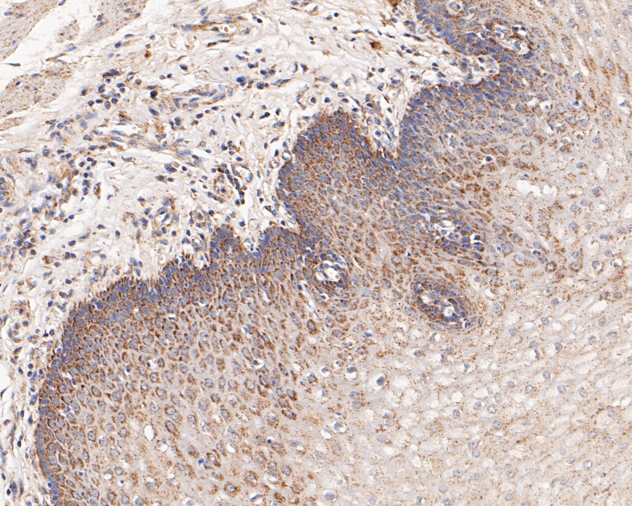 Immunohistochemical analysis of paraffin-embedded human esophagus tissue using anti-CHRNA3 antibody. The section was pre-treated using heat mediated antigen retrieval with Tris-EDTA buffer (pH 8.0-8.4) for 20 minutes.The tissues were blocked in 5% BSA for 30 minutes at room temperature, washed with ddH2O and PBS, and then probed with the primary antibody (ER1902-13, 1/50) for 30 minutes at room temperature. The detection was performed using an HRP conjugated compact polymer system. DAB was used as the chromogen. Tissues were counterstained with hematoxylin and mounted with DPX.