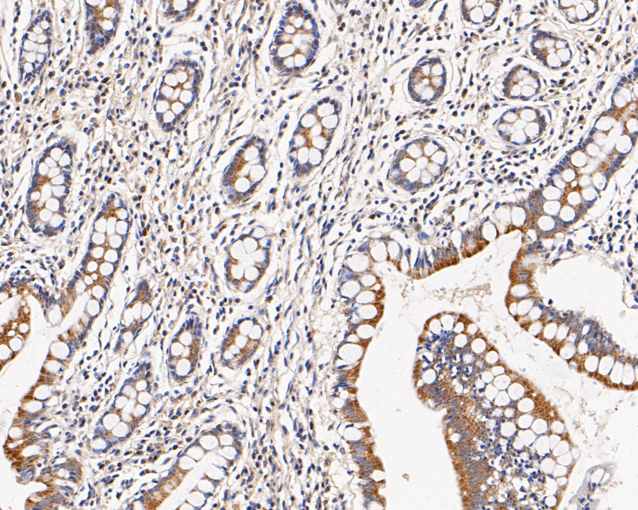 Immunohistochemical analysis of paraffin-embedded human small intestine tissue using anti-CHRNA3 antibody. The section was pre-treated using heat mediated antigen retrieval with Tris-EDTA buffer (pH 8.0-8.4) for 20 minutes.The tissues were blocked in 5% BSA for 30 minutes at room temperature, washed with ddH2O and PBS, and then probed with the primary antibody (ER1902-13, 1/50) for 30 minutes at room temperature. The detection was performed using an HRP conjugated compact polymer system. DAB was used as the chromogen. Tissues were counterstained with hematoxylin and mounted with DPX.