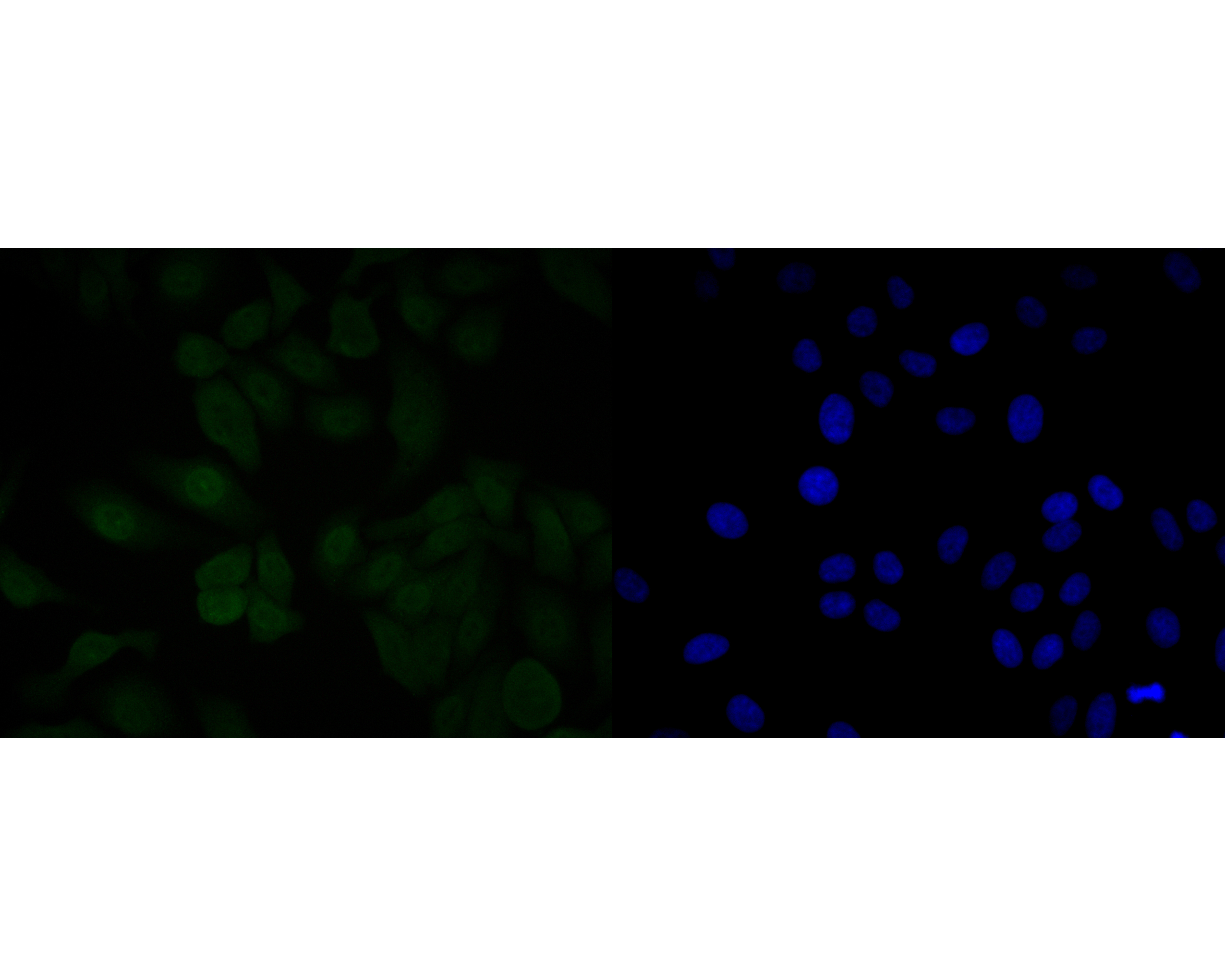 ICC staining of MDM2 in HepG2 cells (green). Formalin fixed cells were permeabilized with 0.1% Triton X-100 in TBS for 10 minutes at room temperature and blocked with 1% Blocker BSA for 15 minutes at room temperature. Cells were probed with the primary antibody (ER1902-14, 1/200) for 1 hour at room temperature, washed with PBS. Alexa Fluor®488 Goat anti-Rabbit IgG was used as the secondary antibody at 1/1,000 dilution. The nuclear counter stain is DAPI (blue).