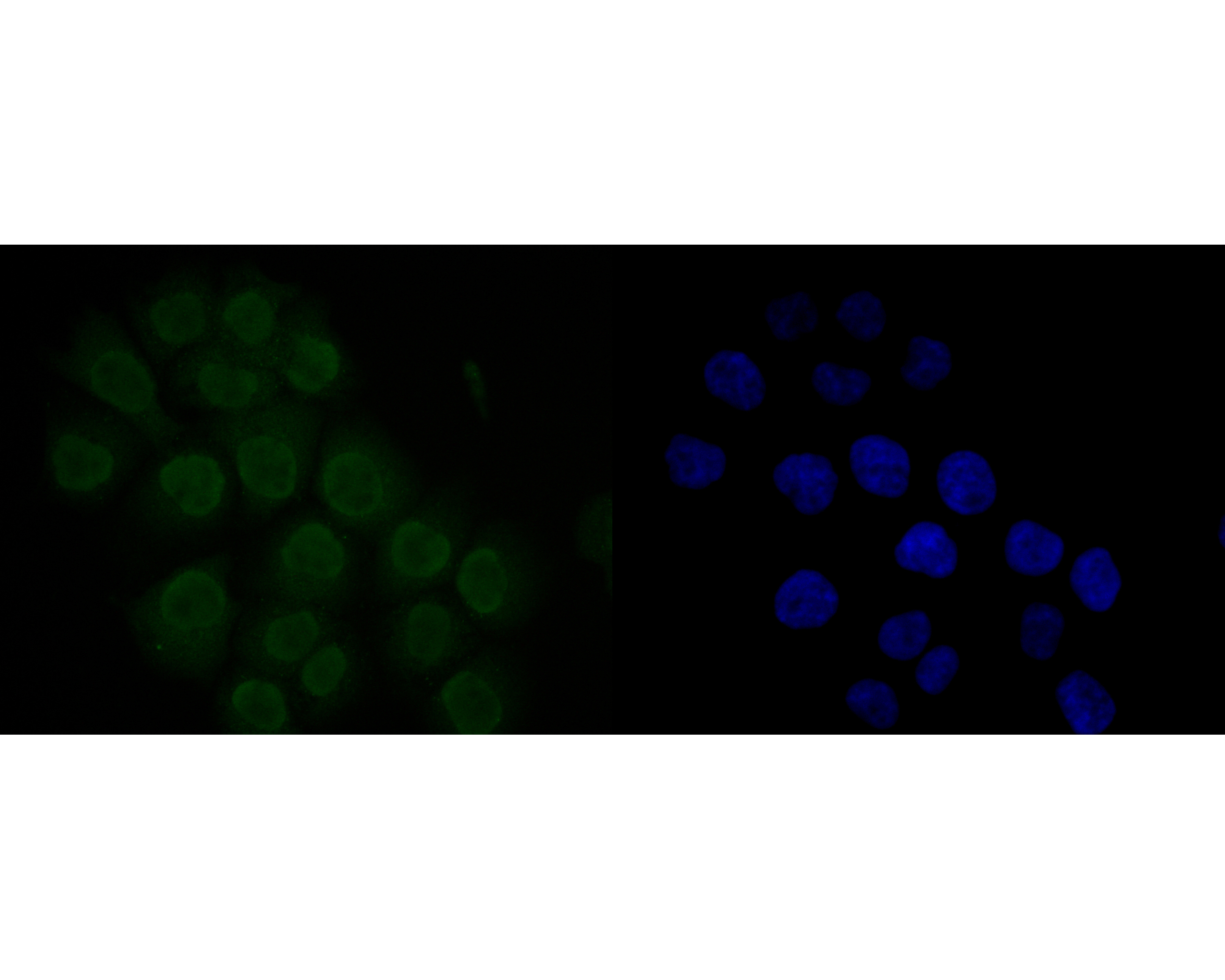 ICC staining of MDM2 in JAR cells (green). Formalin fixed cells were permeabilized with 0.1% Triton X-100 in TBS for 10 minutes at room temperature and blocked with 1% Blocker BSA for 15 minutes at room temperature. Cells were probed with the primary antibody (ER1902-14, 1/200) for 1 hour at room temperature, washed with PBS. Alexa Fluor®488 Goat anti-Rabbit IgG was used as the secondary antibody at 1/1,000 dilution. The nuclear counter stain is DAPI (blue).