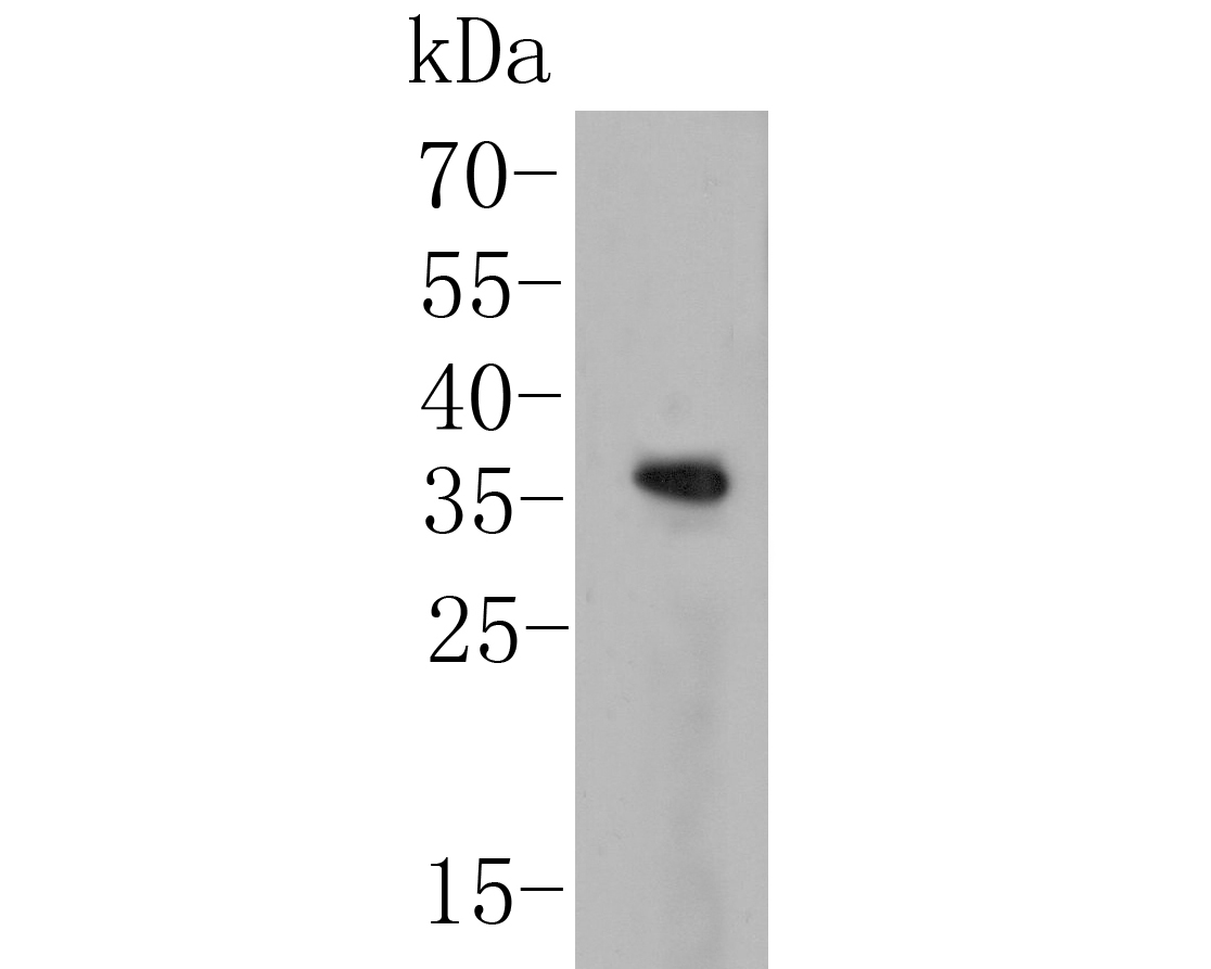 Western blot analysis of KChIP1 on human skin tissue lysate. Proteins were transferred to a PVDF membrane and blocked with 5% BSA in PBS for 1 hour at room temperature. The primary antibody (ER1902-17, 1/500) was used in 5% BSA at room temperature for 2 hours. Goat Anti-Rabbit IgG - HRP Secondary Antibody (HA1001) at 1:5,000 dilution was used for 1 hour at room temperature.