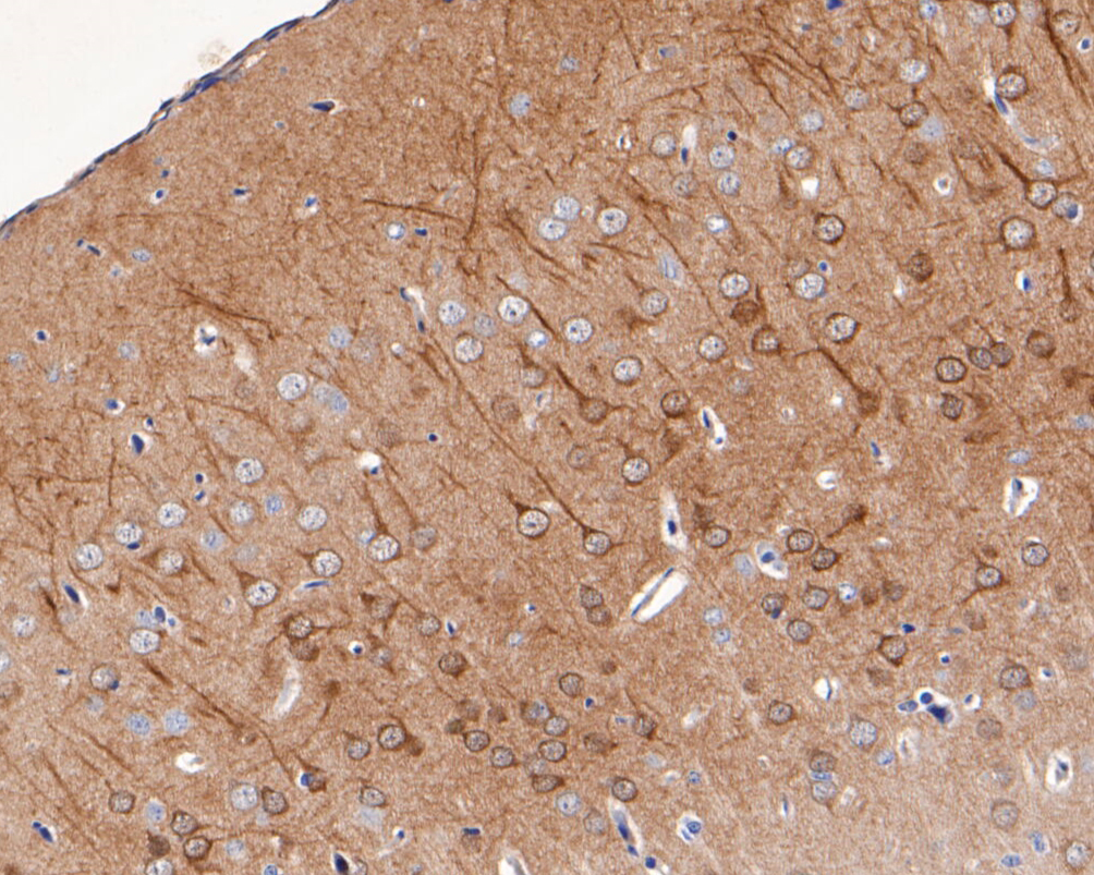 Immunohistochemical analysis of paraffin-embedded rat brain tissue using anti-KChIP1 antibody. The section was pre-treated using heat mediated antigen retrieval with Tris-EDTA buffer (pH 8.0-8.4) for 20 minutes.The tissues were blocked in 5% BSA for 30 minutes at room temperature, washed with ddH2O and PBS, and then probed with the primary antibody (ER1902-17, 1/50) for 30 minutes at room temperature. The detection was performed using an HRP conjugated compact polymer system. DAB was used as the chromogen. Tissues were counterstained with hematoxylin and mounted with DPX.