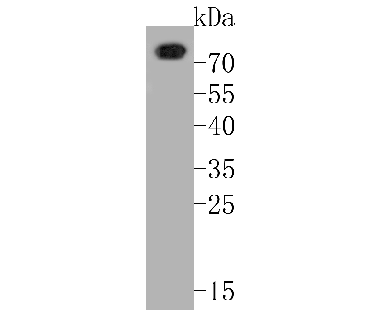 Western blot analysis of CD68 on human spleen tissue lysates. Proteins were transferred to a PVDF membrane and blocked with 5% BSA in PBS for 1 hour at room temperature. The primary antibody (ER1902-21, 1/500) was used in 5% BSA at room temperature for 2 hours. Goat Anti-Rabbit IgG - HRP Secondary Antibody (HA1001) at 1:5,000 dilution was used for 1 hour at room temperature.