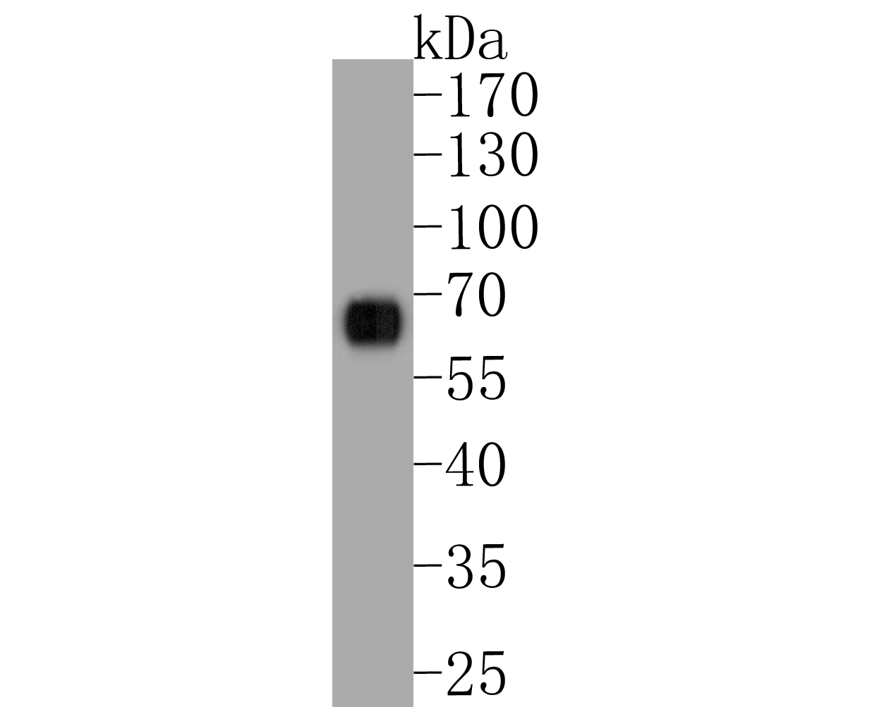 Western blot analysis of GSDMC on human stomach tissue lysates. Proteins were transferred to a PVDF membrane and blocked with 5% BSA in PBS for 1 hour at room temperature. The primary antibody (ER1902-22, 1/1000) was used in 5% BSA at room temperature for 2 hours. Goat Anti-Rabbit IgG - HRP Secondary Antibody (HA1001) at 1:5,000 dilution was used for 1 hour at room temperature.
