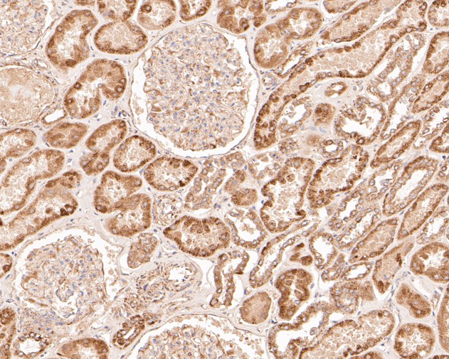 Immunohistochemical analysis of paraffin-embedded human kidney tissue using anti-GSDMC antibody. The section was pre-treated using heat mediated antigen retrieval with Tris-EDTA buffer (pH 8.0-8.4) for 20 minutes.The tissues were blocked in 5% BSA for 30 minutes at room temperature, washed with ddH2O and PBS, and then probed with the primary antibody (ER1902-22, 1/200) for 30 minutes at room temperature. The detection was performed using an HRP conjugated compact polymer system. DAB was used as the chromogen. Tissues were counterstained with hematoxylin and mounted with DPX.