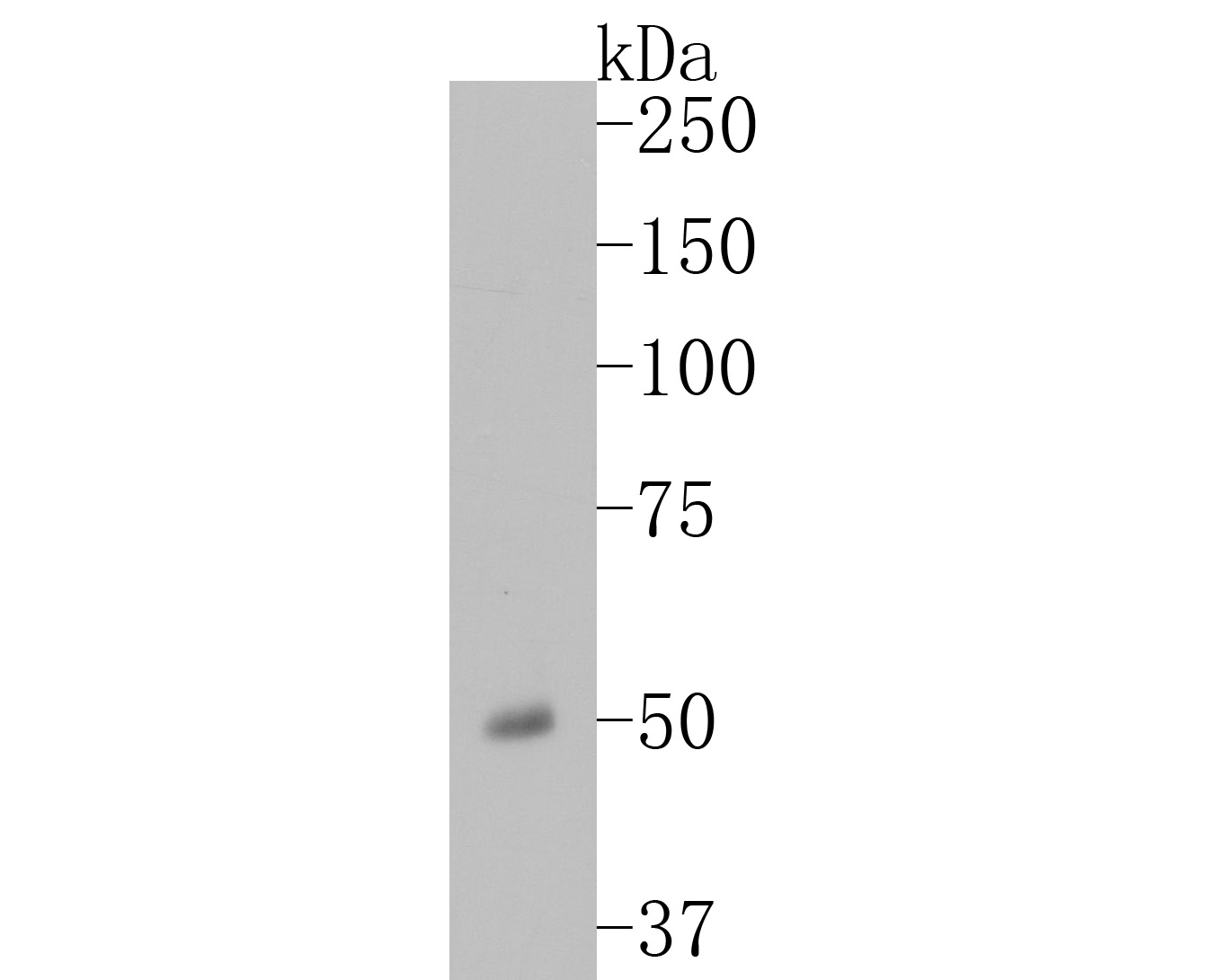 Western blot analysis of ETN1 on Human plasma lysates. Proteins were transferred to a PVDF membrane and blocked with 5% BSA in PBS for 1 hour at room temperature. The primary antibody (ER1902-23, 1/500) was used in 5% BSA at room temperature for 2 hours. Goat Anti-Rabbit IgG - HRP Secondary Antibody (HA1001) at 1:5,000 dilution was used for 1 hour at room temperature.