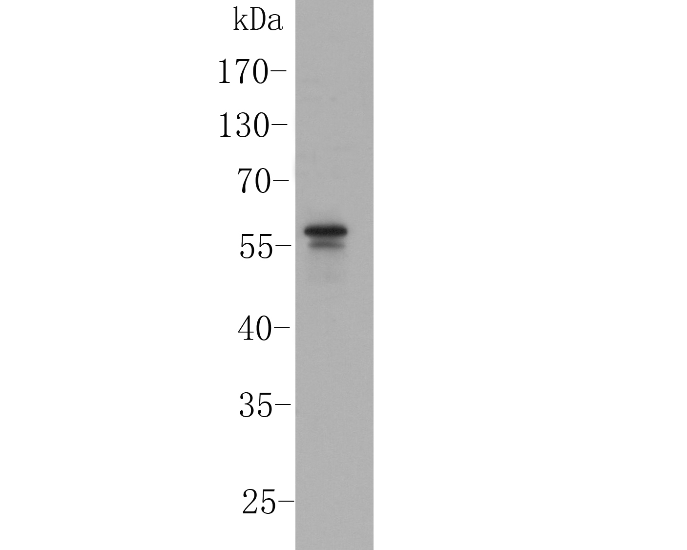 Western blot analysis of PPAR delta on mouse colon tissue lysate. Proteins were transferred to a PVDF membrane and blocked with 5% BSA in PBS for 1 hour at room temperature. The primary antibody (ER1902-24, 1/500) was used in 5% BSA at room temperature for 2 hours. Goat Anti-Rabbit IgG - HRP Secondary Antibody (HA1001) at 1:5,000 dilution was used for 1 hour at room temperature.