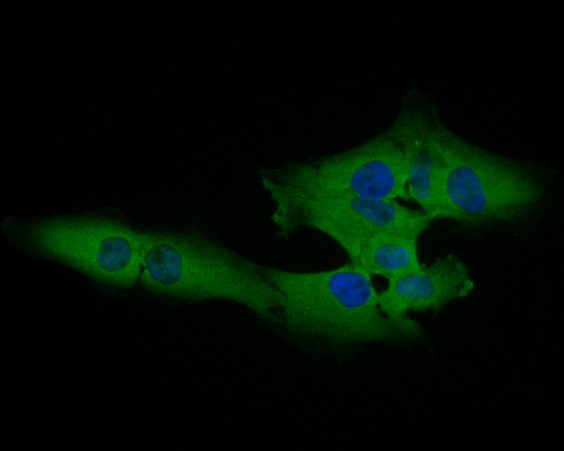 ICC staining of TNNC1 in MG-63 cells (green). Formalin fixed cells were permeabilized with 0.1% Triton X-100 in TBS for 10 minutes at room temperature and blocked with 1% Blocker BSA for 15 minutes at room temperature. Cells were probed with the primary antibody (ER1902-25, 1/100) for 1 hour at room temperature, washed with PBS. Alexa Fluor®488 Goat anti-Rabbit IgG was used as the secondary antibody at 1/1,000 dilution. The nuclear counter stain is DAPI (blue).