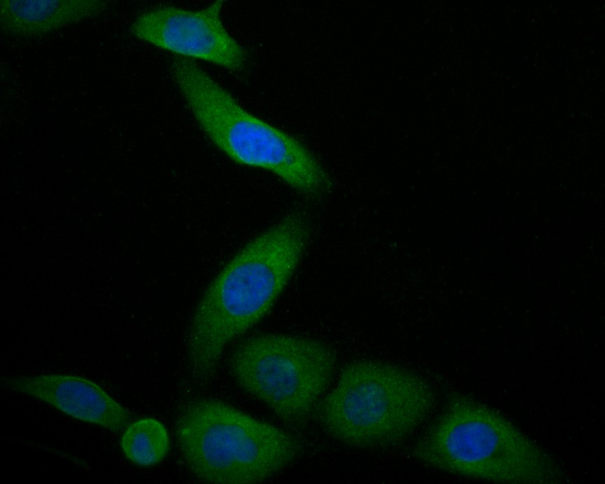 ICC staining of TNNC1 in SKOV-3 cells (green). Formalin fixed cells were permeabilized with 0.1% Triton X-100 in TBS for 10 minutes at room temperature and blocked with 1% Blocker BSA for 15 minutes at room temperature. Cells were probed with the primary antibody (ER1902-25, 1/100) for 1 hour at room temperature, washed with PBS. Alexa Fluor®488 Goat anti-Rabbit IgG was used as the secondary antibody at 1/1,000 dilution. The nuclear counter stain is DAPI (blue).