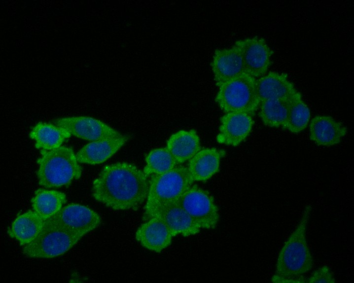ICC staining of TNNC1 in SW620 cells (green). Formalin fixed cells were permeabilized with 0.1% Triton X-100 in TBS for 10 minutes at room temperature and blocked with 1% Blocker BSA for 15 minutes at room temperature. Cells were probed with the primary antibody (ER1902-25, 1/100) for 1 hour at room temperature, washed with PBS. Alexa Fluor®488 Goat anti-Rabbit IgG was used as the secondary antibody at 1/1,000 dilution. The nuclear counter stain is DAPI (blue).