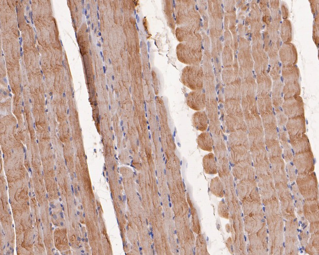 Immunohistochemical analysis of paraffin-embedded rat skeletal muscle tissue using anti-TNNC1 antibody. The section was pre-treated using heat mediated antigen retrieval with Tris-EDTA buffer (pH 8.0-8.4) for 20 minutes.The tissues were blocked in 5% BSA for 30 minutes at room temperature, washed with ddH2O and PBS, and then probed with the primary antibody (ER1902-25, 1/200) for 30 minutes at room temperature. The detection was performed using an HRP conjugated compact polymer system. DAB was used as the chromogen. Tissues were counterstained with hematoxylin and mounted with DPX.