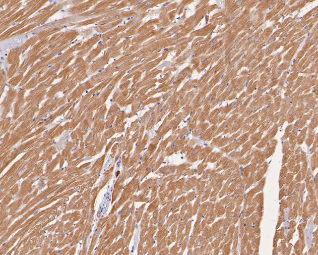 Immunohistochemical analysis of paraffin-embedded rat heart tissue using anti-TNNC1 antibody. The section was pre-treated using heat mediated antigen retrieval with Tris-EDTA buffer (pH 8.0-8.4) for 20 minutes.The tissues were blocked in 5% BSA for 30 minutes at room temperature, washed with ddH2O and PBS, and then probed with the primary antibody (ER1902-25, 1/200) for 30 minutes at room temperature. The detection was performed using an HRP conjugated compact polymer system. DAB was used as the chromogen. Tissues were counterstained with hematoxylin and mounted with DPX.