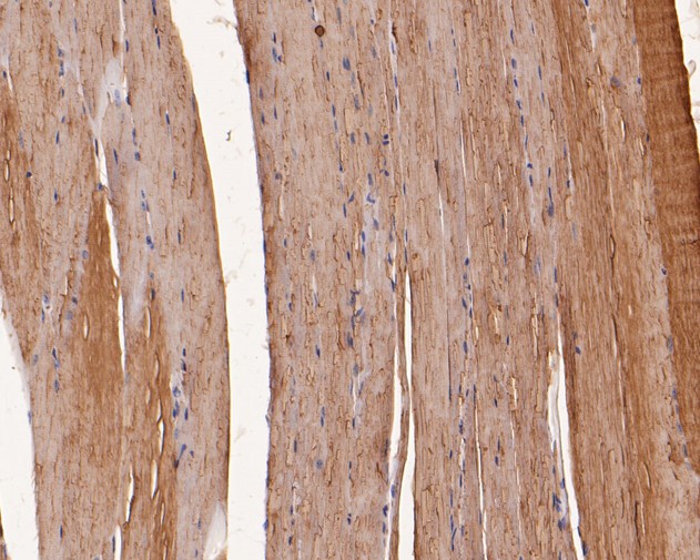 Immunohistochemical analysis of paraffin-embedded mouse skeletal muscle tissue using anti-TNNC1 antibody. The section was pre-treated using heat mediated antigen retrieval with Tris-EDTA buffer (pH 8.0-8.4) for 20 minutes.The tissues were blocked in 5% BSA for 30 minutes at room temperature, washed with ddH2O and PBS, and then probed with the primary antibody (ER1902-25, 1/200) for 30 minutes at room temperature. The detection was performed using an HRP conjugated compact polymer system. DAB was used as the chromogen. Tissues were counterstained with hematoxylin and mounted with DPX.
