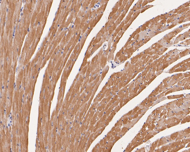 Immunohistochemical analysis of paraffin-embedded mouse heart tissue using anti-TNNC1 antibody. The section was pre-treated using heat mediated antigen retrieval with Tris-EDTA buffer (pH 8.0-8.4) for 20 minutes.The tissues were blocked in 5% BSA for 30 minutes at room temperature, washed with ddH2O and PBS, and then probed with the primary antibody (ER1902-25, 1/200) for 30 minutes at room temperature. The detection was performed using an HRP conjugated compact polymer system. DAB was used as the chromogen. Tissues were counterstained with hematoxylin and mounted with DPX.