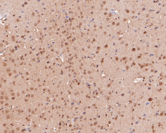 Immunohistochemical analysis of paraffin-embedded mouse brain tissue using anti-PTEN antibody. The section was pre-treated using heat mediated antigen retrieval with Tris-EDTA buffer (pH 8.0-8.4) for 20 minutes.The tissues were blocked in 5% BSA for 30 minutes at room temperature, washed with ddH2O and PBS, and then probed with the primary antibody (ER1902-27, 1/200) for 30 minutes at room temperature. The detection was performed using an HRP conjugated compact polymer system. DAB was used as the chromogen. Tissues were counterstained with hematoxylin and mounted with DPX.