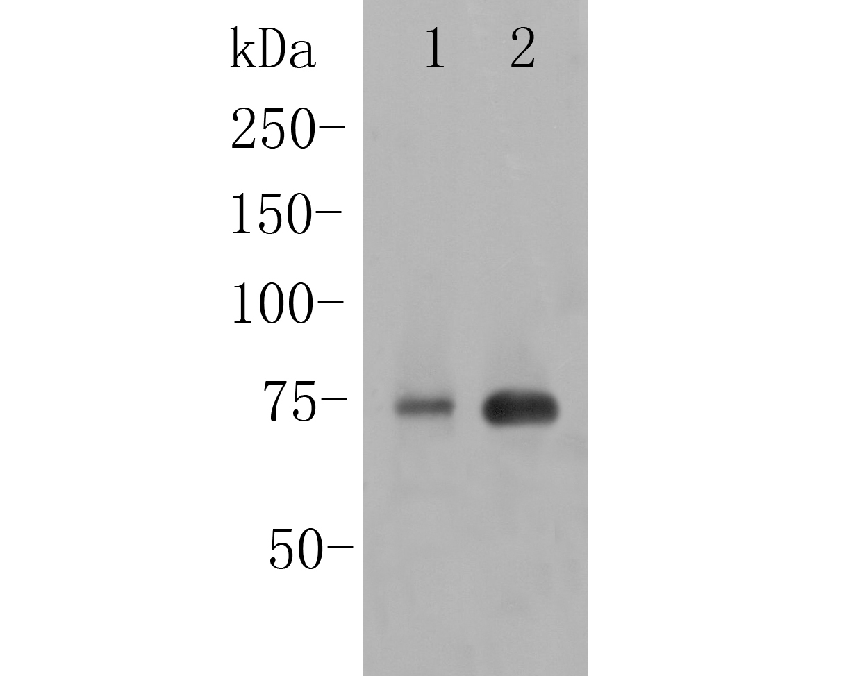 Western blot analysis of Transglutaminase 2 on different lysates. Proteins were transferred to a PVDF membrane and blocked with 5% BSA in PBS for 1 hour at room temperature. The primary antibody (ER1902-28, 1/2000) was used in 5% BSA at room temperature for 2 hours. Goat Anti-Rabbit IgG - HRP Secondary Antibody (HA1001) at 1:5,000 dilution was used for 1 hour at room temperature.<br />
Positive control: <br />
Lane 1: HUVEC cell lysate<br />
Lane 2: Mouse lung tissue lysate