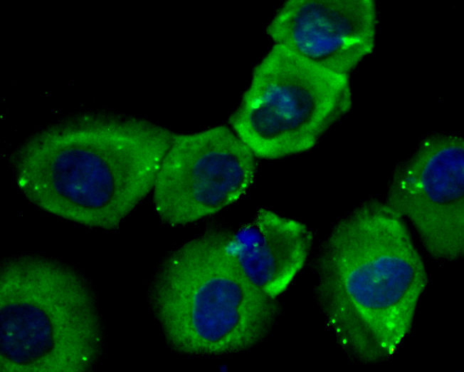 ICC staining of Transglutaminase 2 in HUVEC cells (green). Formalin fixed cells were permeabilized with 0.1% Triton X-100 in TBS for 10 minutes at room temperature and blocked with 1% Blocker BSA for 15 minutes at room temperature. Cells were probed with the primary antibody (ER1902-28, 1/100) for 1 hour at room temperature, washed with PBS. Alexa Fluor®488 Goat anti-Rabbit IgG was used as the secondary antibody at 1/100 dilution. The nuclear counter stain is DAPI (blue).