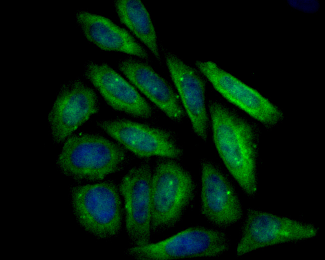 ICC staining of Transglutaminase 2 in Siha cells (green). Formalin fixed cells were permeabilized with 0.1% Triton X-100 in TBS for 10 minutes at room temperature and blocked with 1% Blocker BSA for 15 minutes at room temperature. Cells were probed with the primary antibody (ER1902-28, 1/100) for 1 hour at room temperature, washed with PBS. Alexa Fluor®488 Goat anti-Rabbit IgG was used as the secondary antibody at 1/100 dilution. The nuclear counter stain is DAPI (blue).
