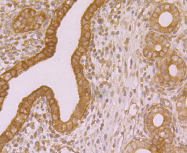 Immunohistochemical analysis of paraffin-embedded Rat uterus tissue using anti-Transglutaminase 2 antibody. The section was pre-treated using heat mediated antigen retrieval with sodium citrate buffer (pH 6.0) for 20 minutes. The tissues were blocked in 5% BSA for 30 minutes at room temperature, washed with ddH2O and PBS, and then probed with the primary antibody (ER1902-28, 1/200)  for 30 minutes at room temperature. The detection was performed using an HRP conjugated compact polymer system. DAB was used as the chromogen. Tissues were counterstained with hematoxylin and mounted with DPX.