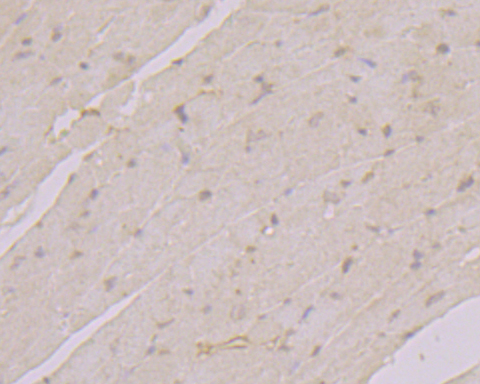 Immunohistochemical analysis of paraffin-embedded mouse heart tissue using anti-Transglutaminase 2 antibody. The section was pre-treated using heat mediated antigen retrieval with sodium citrate buffer (pH 6.0) for 20 minutes. The tissues were blocked in 5% BSA for 30 minutes at room temperature, washed with ddH2O and PBS, and then probed with the primary antibody (ER1902-28, 1/800)  for 30 minutes at room temperature. The detection was performed using an HRP conjugated compact polymer system. DAB was used as the chromogen. Tissues were counterstained with hematoxylin and mounted with DPX.