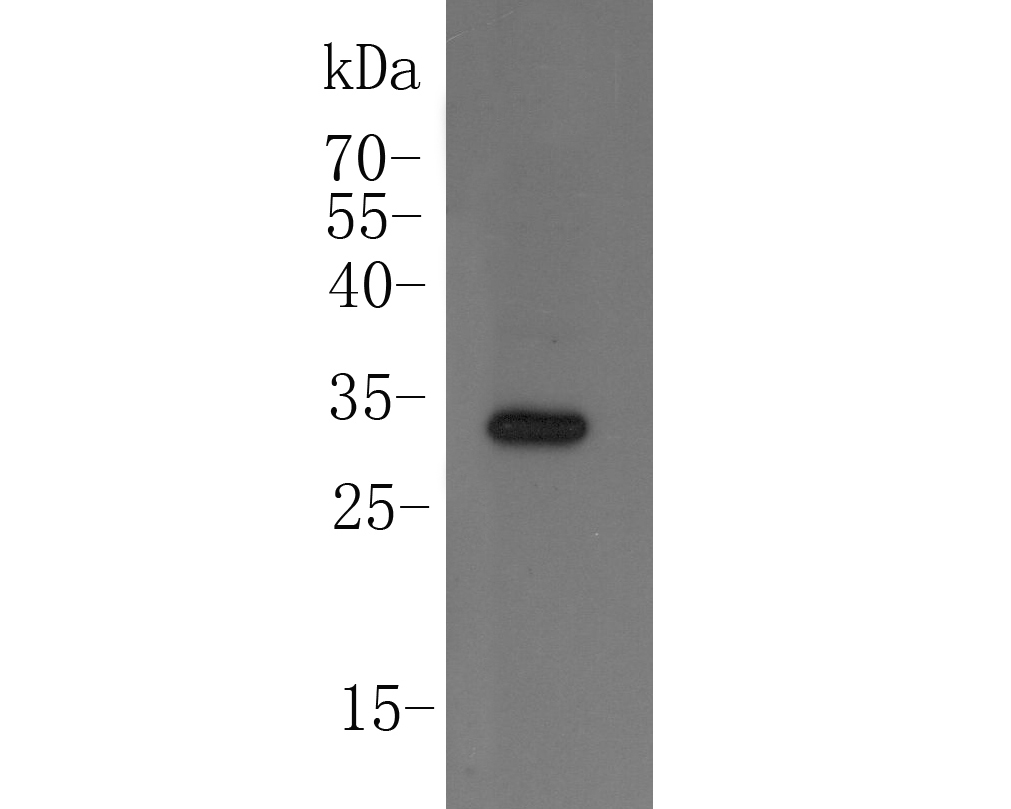 Western blot analysis of Mcur1 on mouse brain tissue lysate. Proteins were transferred to a PVDF membrane and blocked with 5% BSA in PBS for 1 hour at room temperature. The primary antibody (ER1902-30, 1/500) was used in 5% BSA at room temperature for 2 hours. Goat Anti-Rabbit IgG - HRP Secondary Antibody (HA1001) at 1:5,000 dilution was used for 1 hour at room temperature.