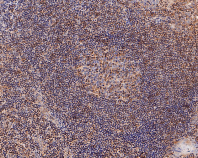 Immunohistochemical analysis of paraffin-embedded human tonsil tissue using anti-TMX4 antibody. The section was pre-treated using heat mediated antigen retrieval with Tris-EDTA buffer (pH 8.0-8.4) for 20 minutes.The tissues were blocked in 5% BSA for 30 minutes at room temperature, washed with ddH2O and PBS, and then probed with the primary antibody (ER1902-31, 1/50) for 30 minutes at room temperature. The detection was performed using an HRP conjugated compact polymer system. DAB was used as the chromogen. Tissues were counterstained with hematoxylin and mounted with DPX.