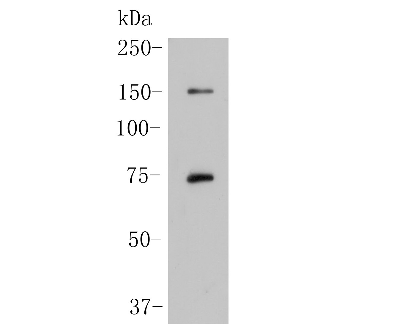Western blot analysis of SPATA13 on rat kidney tissue lysate. Proteins were transferred to a PVDF membrane and blocked with 5% BSA in PBS for 1 hour at room temperature. The primary antibody (ER1902-32, 1/500) was used in 5% BSA at room temperature for 2 hours. Goat Anti-Rabbit IgG - HRP Secondary Antibody (HA1001) at 1:5,000 dilution was used for 1 hour at room temperature.