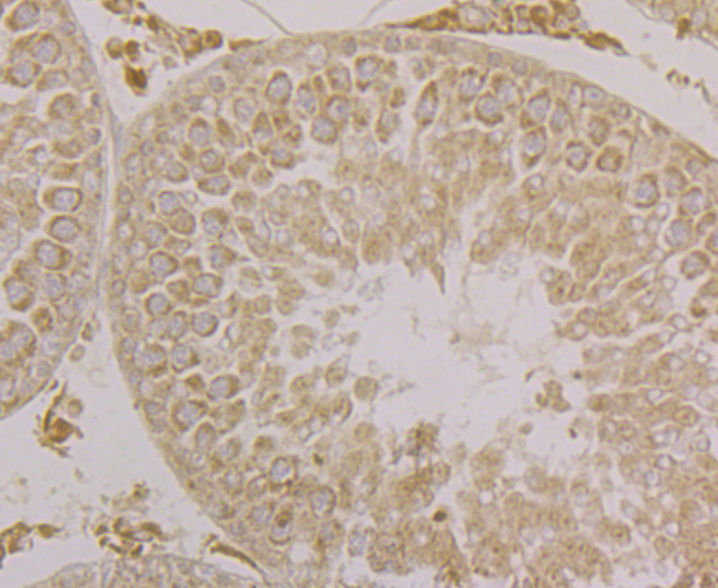 Immunohistochemical analysis of paraffin-embedded rat testis tissue using anti-SPATA13 antibody. The section was pre-treated using heat mediated antigen retrieval with Tris-EDTA buffer (pH 8.0-8.4) for 20 minutes.The tissues were blocked in 5% BSA for 30 minutes at room temperature, washed with ddH2O and PBS, and then probed with the primary antibody (ER1902-32, 1/50) for 30 minutes at room temperature. The detection was performed using an HRP conjugated compact polymer system. DAB was used as the chromogen. Tissues were counterstained with hematoxylin and mounted with DPX.