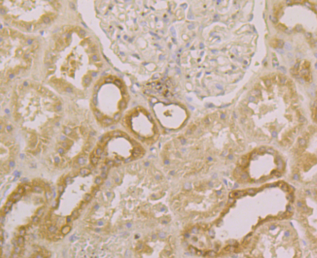 Immunohistochemical analysis of paraffin-embedded human kidney tissue using anti-SPATA13 antibody. The section was pre-treated using heat mediated antigen retrieval with Tris-EDTA buffer (pH 8.0-8.4) for 20 minutes.The tissues were blocked in 5% BSA for 30 minutes at room temperature, washed with ddH2O and PBS, and then probed with the primary antibody (ER1902-32, 1/200) for 30 minutes at room temperature. The detection was performed using an HRP conjugated compact polymer system. DAB was used as the chromogen. Tissues were counterstained with hematoxylin and mounted with DPX.