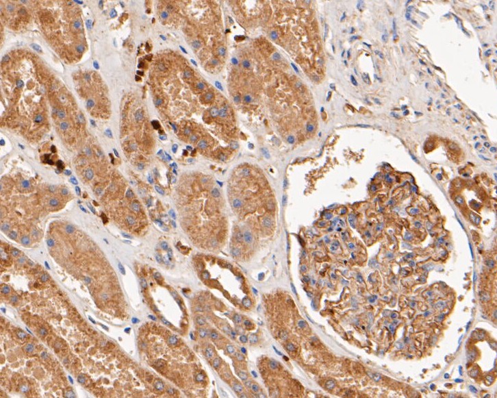 Immunohistochemical analysis of paraffin-embedded human kidney tissue using anti-PTEN antibody. The section was pre-treated using heat mediated antigen retrieval with sodium citrate buffer (pH 6.0) for 20 minutes. The tissues were blocked in 5% BSA for 30 minutes at room temperature, washed with ddH2O and PBS, and then probed with the primary antibody (ER1902-33, 1/50)  for 30 minutes at room temperature. The detection was performed using an HRP conjugated compact polymer system. DAB was used as the chromogen. Tissues were counterstained with hematoxylin and mounted with DPX.