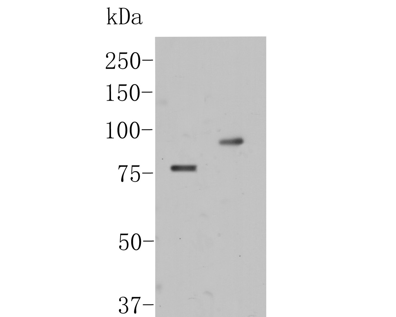 Western blot analysis of Factor XIIIa on different lysates. Proteins were transferred to a PVDF membrane and blocked with 5% BSA in PBS for 1 hour at room temperature. The primary antibody (ER1902-34, 1/500) was used in 5% BSA at room temperature for 2 hours. Goat Anti-Rabbit IgG - HRP Secondary Antibody (HA1001) at 1:5,000 dilution was used for 1 hour at room temperature.<br />
Positive control: <br />
Lane 1: human placenta tissue lysate<br />
Lane 2: human liver tissue lysate