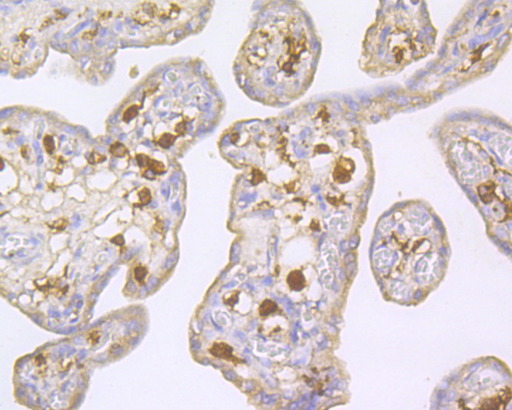 Immunohistochemical analysis of paraffin-embedded human placenta tissue using anti-Factor XIIIa antibody. The section was pre-treated using heat mediated antigen retrieval with Tris-EDTA buffer (pH 8.0-8.4) for 20 minutes.The tissues were blocked in 5% BSA for 30 minutes at room temperature, washed with ddH2O and PBS, and then probed with the primary antibody (ER1902-34, 1/200) for 30 minutes at room temperature. The detection was performed using an HRP conjugated compact polymer system. DAB was used as the chromogen. Tissues were counterstained with hematoxylin and mounted with DPX.