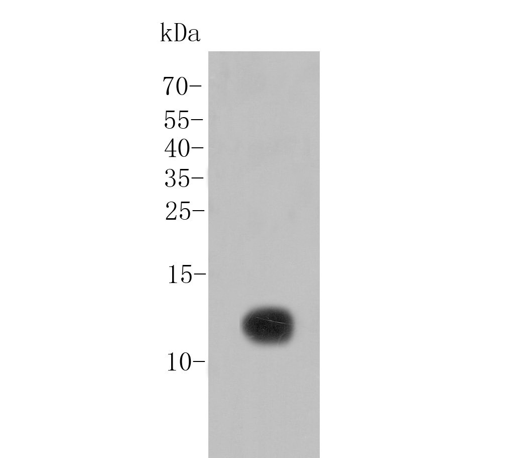 Western blot analysis of SDF1 on recombinant protein lysate. Proteins were transferred to a PVDF membrane and blocked with 5% BSA in PBS for 1 hour at room temperature. The primary antibody (ER1902-35, 1/20,000) was used in 5% BSA at room temperature for 2 hours. Goat Anti-Rabbit IgG - HRP Secondary Antibody (HA1001) at 1:5,000 dilution was used for 1 hour at room temperature.