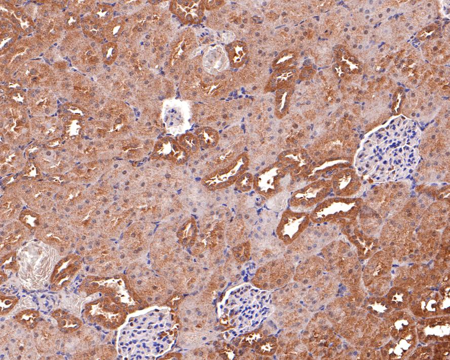 Immunohistochemical analysis of paraffin-embedded rat kidney tissue with Rabbit anti-SDF1 antibody (ER1902-35) at 1/600 dilution.<br />
<br />
The section was pre-treated using heat mediated antigen retrieval with Tris-EDTA buffer (pH 9.0) for 20 minutes. The tissues were blocked in 1% BSA for 20 minutes at room temperature, washed with ddH2O and PBS, and then probed with the primary antibody (ER1902-35) at 1/600 dilution for 1 hour at room temperature. The detection was performed using an HRP conjugated compact polymer system. DAB was used as the chromogen. Tissues were counterstained with hematoxylin and mounted with DPX.