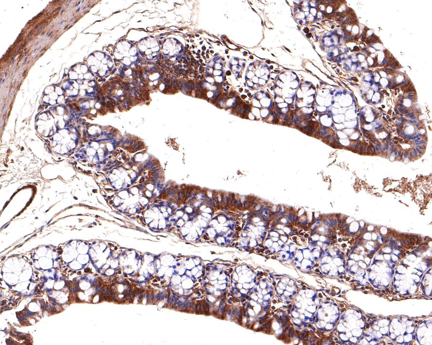 Immunohistochemical analysis of paraffin-embedded  mouse colon  tissue using anti-SDF1 alpha antibody. The section was pre-treated using heat mediated antigen retrieval with Tris-EDTA buffer (pH 8.0-8.4) for 20 minutes.The tissues were blocked in 5% BSA for 30 minutes at room temperature, washed with ddH2O and PBS, and then probed with the primary antibody (ER1902-35, 1/100) for 30 minutes at room temperature. The detection was performed using an HRP conjugated compact polymer system. DAB was used as the chromogen. Tissues were counterstained with hematoxylin and mounted with DPX.