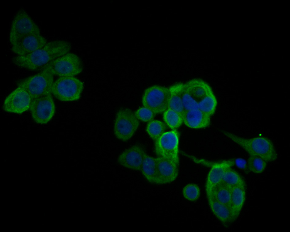 ICC staining of IL18 binding protein in LOVO cells (green). Formalin fixed cells were permeabilized with 0.1% Triton X-100 in TBS for 10 minutes at room temperature and blocked with 1% Blocker BSA for 15 minutes at room temperature. Cells were probed with the primary antibody (ER1902-36, 1/200) for 1 hour at room temperature, washed with PBS. Alexa Fluor®488 Goat anti-Rabbit IgG was used as the secondary antibody at 1/1,000 dilution. The nuclear counter stain is DAPI (blue).