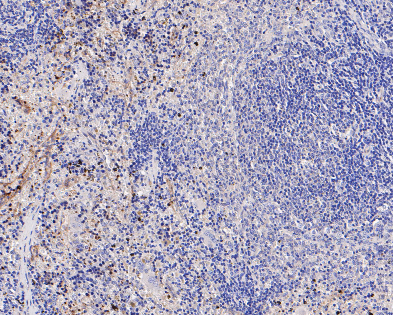 Immunohistochemical analysis of paraffin-embedded rat spleen tissue using anti-IL18 binding protein antibody. The section was pre-treated using heat mediated antigen retrieval with Tris-EDTA buffer (pH 8.0-8.4) for 20 minutes.The tissues were blocked in 5% BSA for 30 minutes at room temperature, washed with ddH2O and PBS, and then probed with the primary antibody (ER1902-36, 1/200) for 30 minutes at room temperature. The detection was performed using an HRP conjugated compact polymer system. DAB was used as the chromogen. Tissues were counterstained with hematoxylin and mounted with DPX.