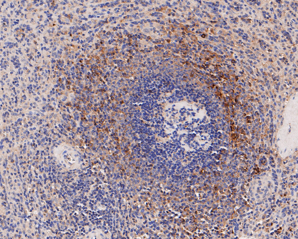 Immunohistochemical analysis of paraffin-embedded human spleen tissue using anti-IL18 binding protein antibody. The section was pre-treated using heat mediated antigen retrieval with Tris-EDTA buffer (pH 8.0-8.4) for 20 minutes.The tissues were blocked in 5% BSA for 30 minutes at room temperature, washed with ddH2O and PBS, and then probed with the primary antibody (ER1902-36, 1/50) for 30 minutes at room temperature. The detection was performed using an HRP conjugated compact polymer system. DAB was used as the chromogen. Tissues were counterstained with hematoxylin and mounted with DPX.