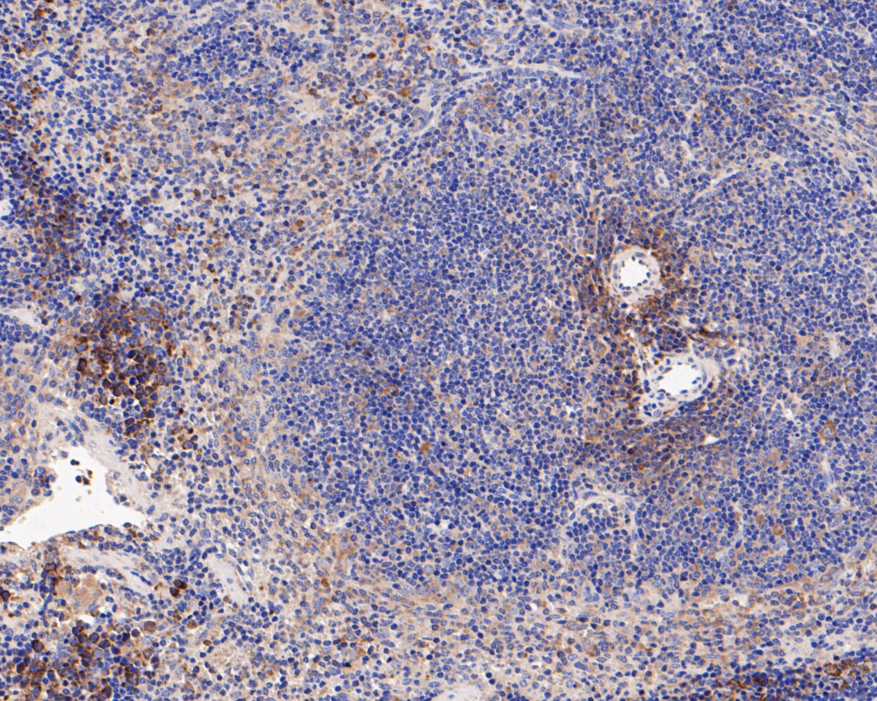 Immunohistochemical analysis of paraffin-embedded mouse spleen tissue using anti-IL18 binding protein antibody. The section was pre-treated using heat mediated antigen retrieval with Tris-EDTA buffer (pH 8.0-8.4) for 20 minutes.The tissues were blocked in 5% BSA for 30 minutes at room temperature, washed with ddH2O and PBS, and then probed with the primary antibody (ER1902-36, 1/200) for 30 minutes at room temperature. The detection was performed using an HRP conjugated compact polymer system. DAB was used as the chromogen. Tissues were counterstained with hematoxylin and mounted with DPX.