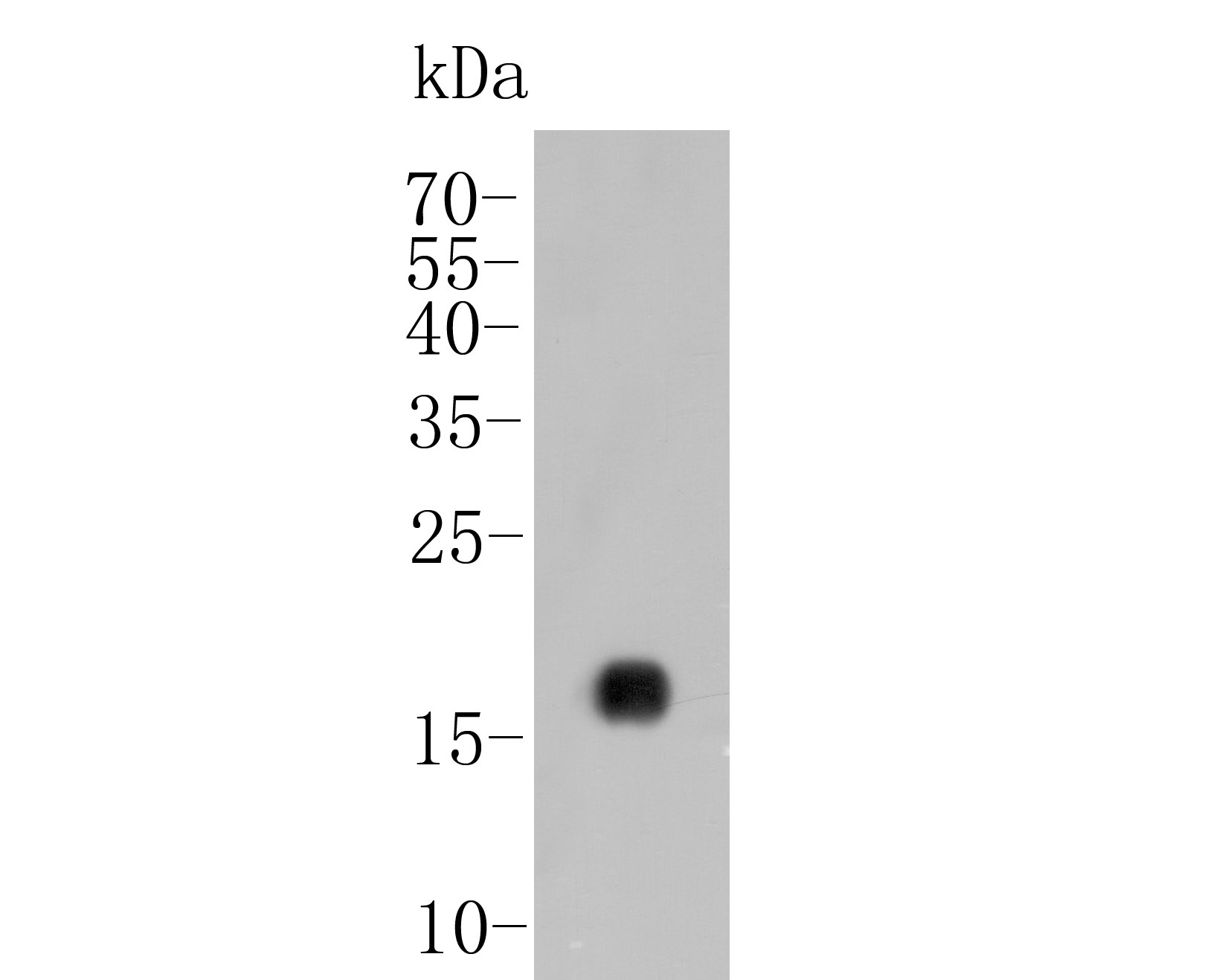 Western blot analysis of IL17A on recombinant protein lysate. Proteins were transferred to a PVDF membrane and blocked with 5% BSA in PBS for 1 hour at room temperature. The primary antibody (ER1902-37, 1/20000) was used in 5% BSA at room temperature for 2 hours. Goat Anti-Rabbit IgG - HRP Secondary Antibody (HA1001) at 1:5,000 dilution was used for 1 hour at room temperature.