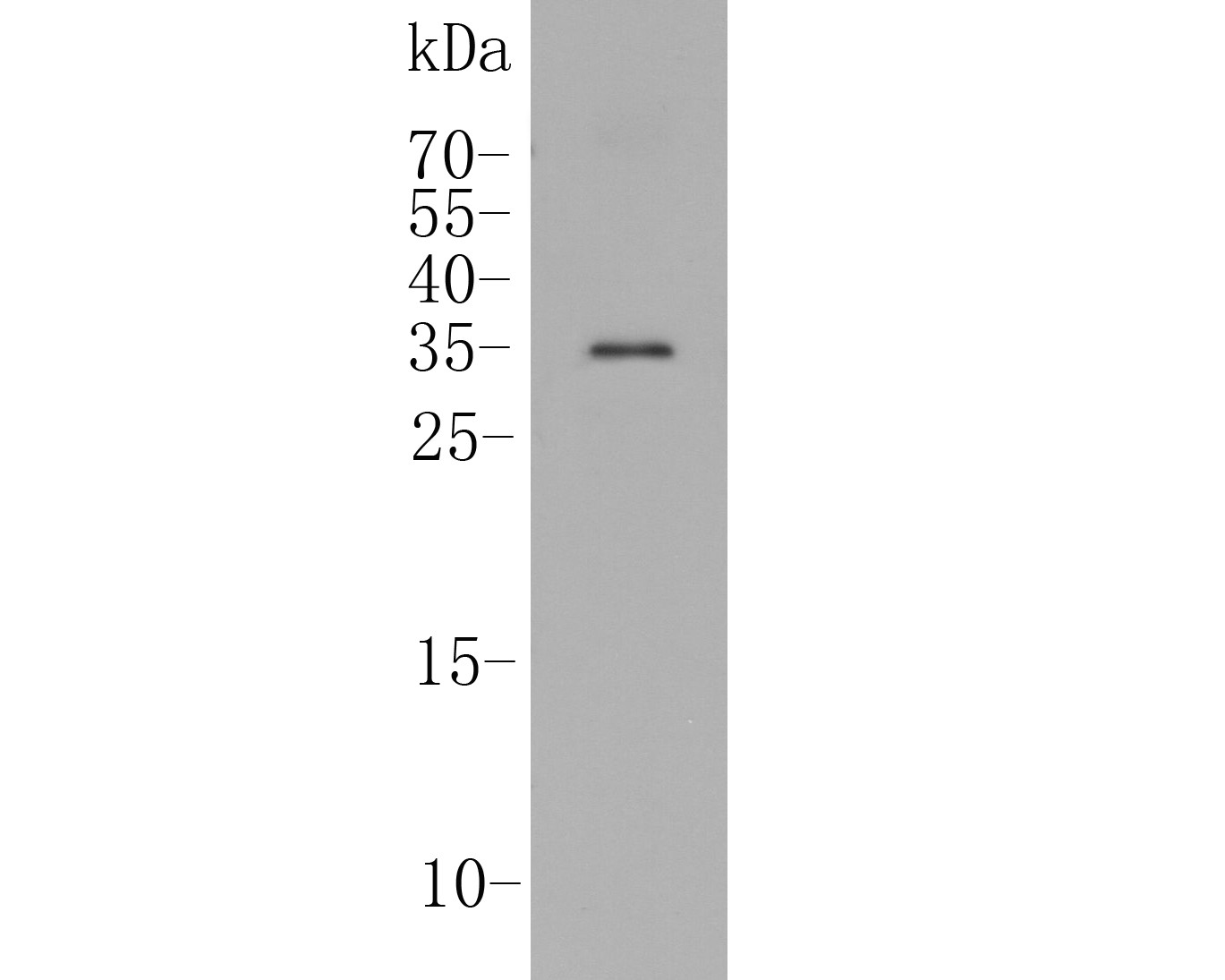 Western blot analysis of IL17A on Rat stomach tissue lysate. Proteins were transferred to a PVDF membrane and blocked with 5% BSA in PBS for 1 hour at room temperature. The primary antibody (ER1902-37, 1/500) was used in 5% BSA at room temperature for 2 hours. Goat Anti-Rabbit IgG - HRP Secondary Antibody (HA1001) at 1:5,000 dilution was used for 1 hour at room temperature.