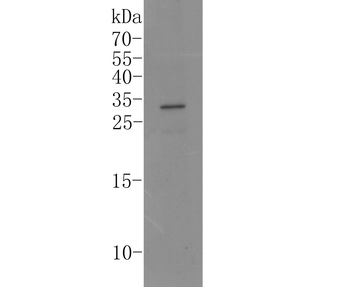 Western blot analysis of IL-17A on Human skeletal muscle tissue lysate. Proteins were transferred to a PVDF membrane and blocked with 5% BSA in PBS for 1 hour at room temperature. The primary antibody (ER1902-37, 1/500) was used in 5% BSA at room temperature for 2 hours. Goat Anti-Rabbit IgG - HRP Secondary Antibody (HA1001) at 1:5,000 dilution was used for 1 hour at room temperature.