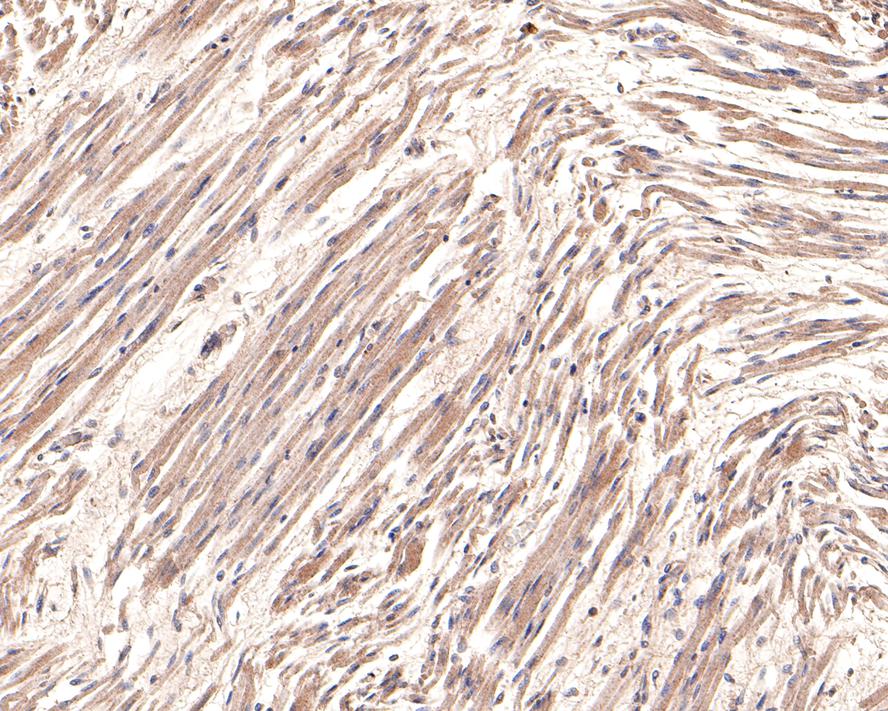 Immunohistochemical analysis of paraffin-embedded human fetal skeletal muscle tissue with Rabbit anti-IL-17A antibody (ER1902-37) at 1/800 dilution.<br />
<br />
The section was pre-treated using heat mediated antigen retrieval with Tris-EDTA buffer (pH 9.0) for 20 minutes. The tissues were blocked in 1% BSA for 20 minutes at room temperature, washed with ddH2O and PBS, and then probed with the primary antibody (ER1902-37) at 1/800 dilution for 1 hour at room temperature. The detection was performed using an HRP conjugated compact polymer system. DAB was used as the chromogen. Tissues were counterstained with hematoxylin and mounted with DPX.